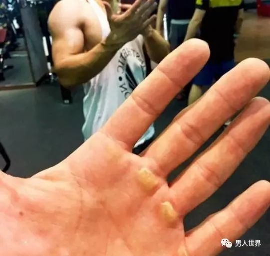 体育生手粗糙的原因及其影响
