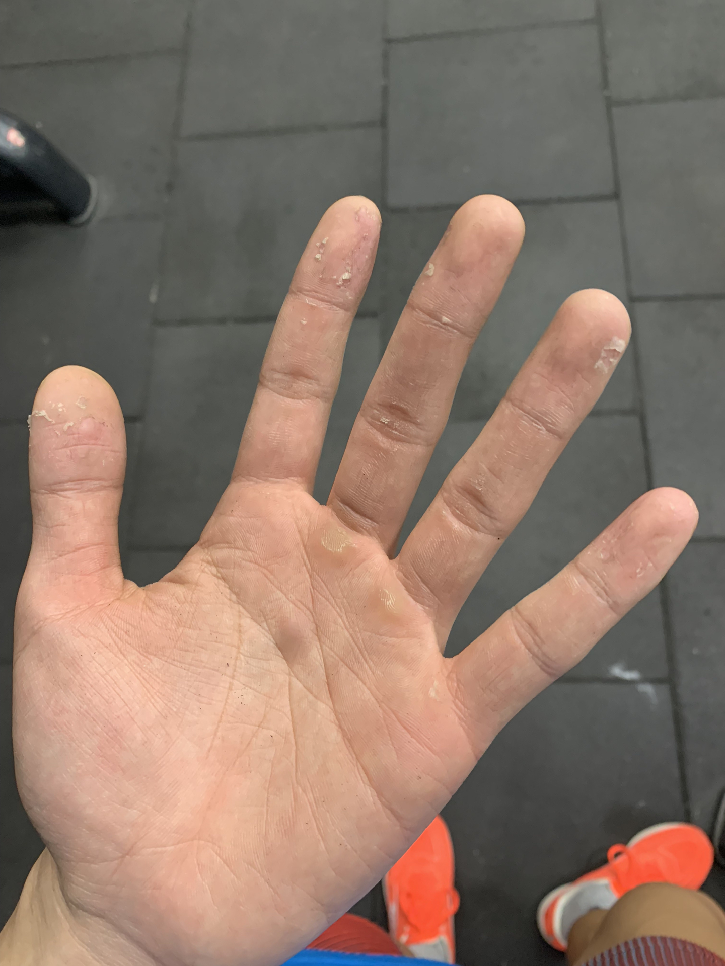 体育生手粗糙的原因及其影响